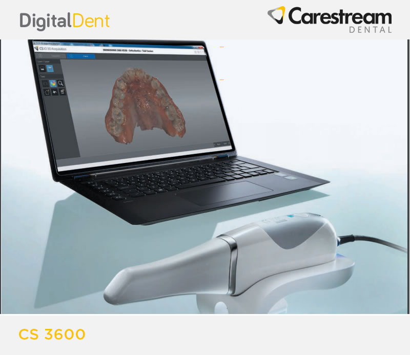 DigitalDent