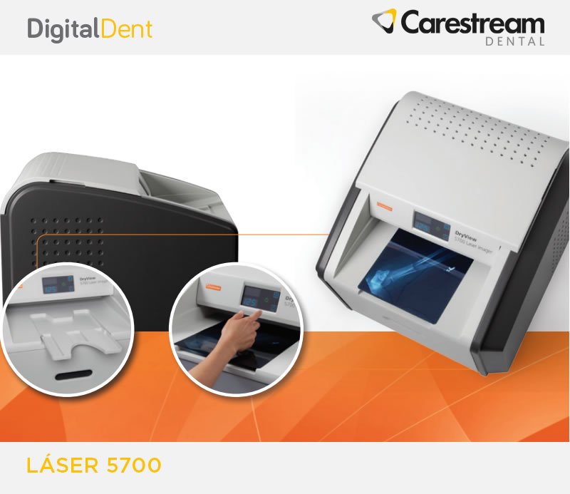 DigitalDent
