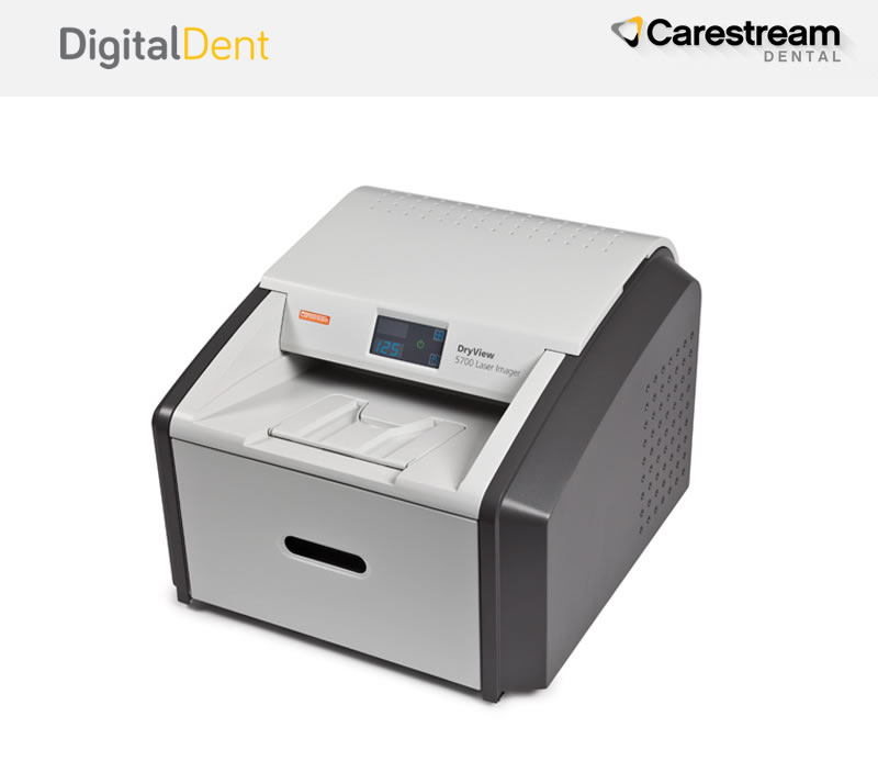 DigitalDent