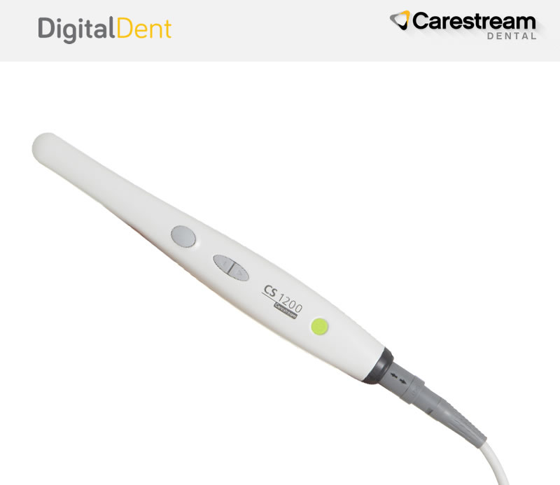 DigitalDent