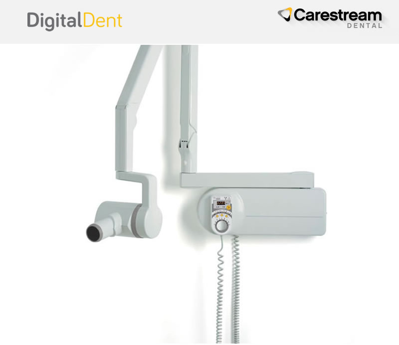 DigitalDent