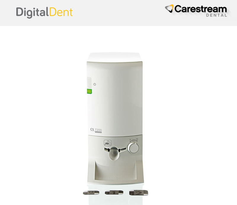 DigitalDent