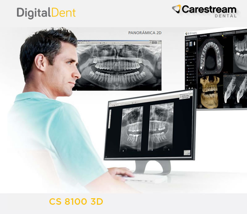 DigitalDent