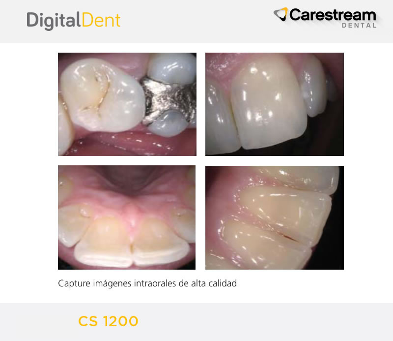 DigitalDent