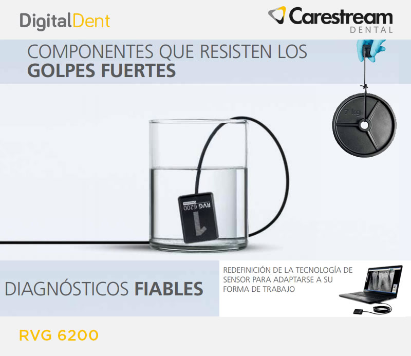 DigitalDent