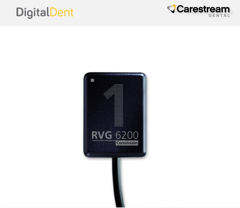 DigitalDent