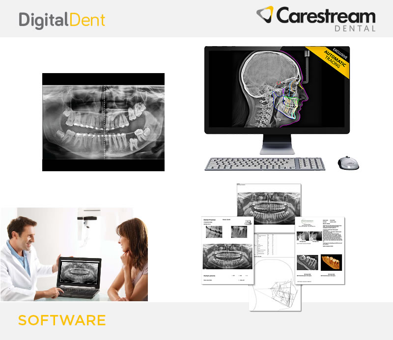 DigitalDent