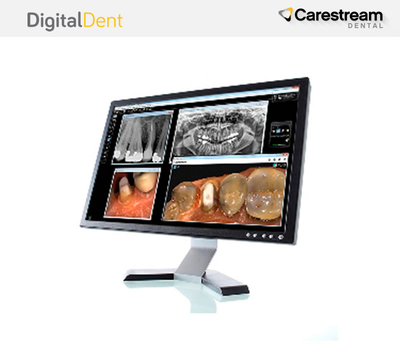 DigitalDent